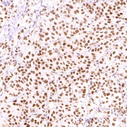 ERCC1供应商_生产厂家 厦门通灵生物医药科技股份有限公司