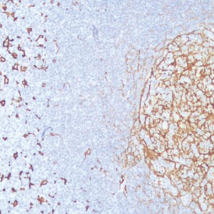 CD14供应商_生产厂家 -厦门通灵生物医药科技股份有限公司